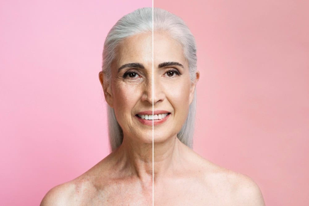 Facelift vs. Non-Surgical Alternatives: Which Is Right for You?