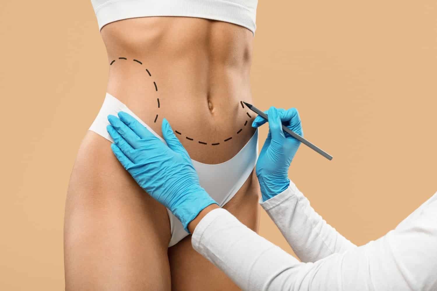 Travelling Abroad for Body Surgery: A Complete Guide