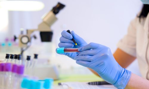 Laboratori Kimik-Biokimik-Mikrobiologjik